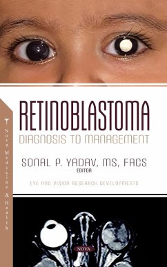 Cover Retinoblastoma: Diagnosis to Management (eBook, PDF)