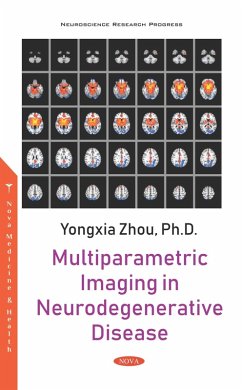 Multiparametric Imaging in Neurodegenerative Disease (eBook, PDF) Multiparametric Imaging in Neurodegenerative Disease (eBook, PDF)