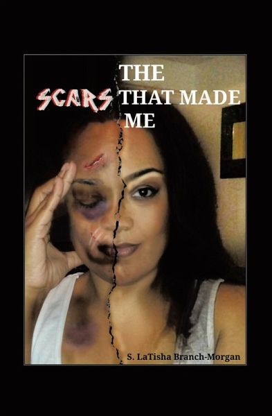 THE SCARS THAT MADE ME (eBook, ePUB) THE SCARS THAT MADE ME (eBook, ePUB)