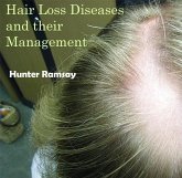 Hair Loss Diseases and their Management (eBook, PDF)