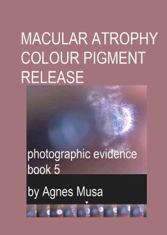 Macular Atrophy Colour Pigment Release, Photographic Evidence Book 5 (Macular Degeneration Atrophy, Photographic Evidence Series of Books, #16) (eBook, ePUB) - Musa, Agnes