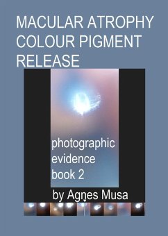 Macular Atrophy Colour Pigment Release, Photographic Evidence Book 2 (Macular Degeneration Atrophy, Photographic Evidence Series of Books, #13) (eBook, ePUB) - Musa, Agnes