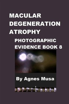 Macular Degeneration, Photographic Evidence Book 8 (Macular Degeneration Atrophy, Photographic Evidence Series of Books, #11) (eBook, ePUB) - Musa, Agnes