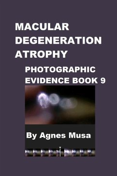 Cover Macular Degeneration Atrophy, Photographic Evidence Book 9 (Macular Degeneration Atrophy, Photographic Evidence Series of Books, #10) (eBook, ePUB)