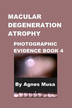 Cover Macular Degeneration Atrophy, Photographic Evidence Book 4 (Macular Degeneration Atrophy, Photographic Evidence Series of Books, #6) (eBook, ePUB)