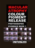 Macular Atrophy Colour Pigment Release, Photographic Evidence Book 1 (Macular Degeneration Atrophy, Photographic Evidence Series of Books, #12) (eBook, ePUB) Macular Atrophy Colour Pigment Release, Photographic Evidence Book 1 (Macular Degeneration Atrophy, Photographic Evidence Series of Books, #12) (eBook, ePUB)