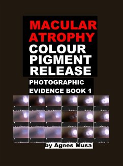 Cover Macular Atrophy Colour Pigment Release, Photographic Evidence Book 1 (Macular Degeneration Atrophy, Photographic Evidence Series of Books, #12) (eBook, ePUB)