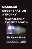 Macular Degeneration Atrophy, Photographic Evidence Book 11 (Macular Degeneration Atrophy, Photographic Evidence Series of Books, #3) (eBook, ePUB) Macular Degeneration Atrophy, Photographic Evidence Book 11 (Macular Degeneration Atrophy, Photographic Evidence Series of Books, #3) (eBook, ePUB)