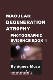 Macular Degeneration Atrophy, Photographic Evidence Book 1 (Macular Degeneration Atrophy, Photographic Evidence Series of Books, #1) (eBook, ePUB) Macular Degeneration Atrophy, Photographic Evidence Book 1 (Macular Degeneration Atrophy, Photographic Evidence Series of Books, #1) (eBook, ePUB)