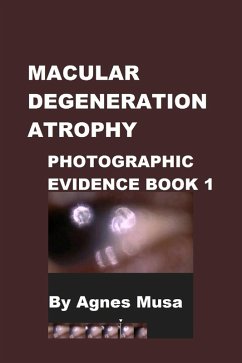 Cover Macular Degeneration Atrophy, Photographic Evidence Book 1 (Macular Degeneration Atrophy, Photographic Evidence Series of Books, #1) (eBook, ePUB)