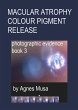 Macular Atrophy Colour Pigment Release,... - Bild 1
