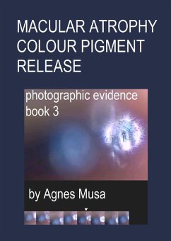 Cover Macular Atrophy Colour Pigment Release, Photographic Evidence Book 3 (Macular Degeneration Atrophy, Photographic Evidence Series of Books, #14) (eBook, ePUB)
