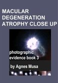 Macular Degeneration Atrophy Close Up, Photographic Evidence Book 3 (Macular Degeneration Atrophy, Photographic Evidence Series of Books, #19) (eBook, ePUB) Macular Degeneration Atrophy Close Up, Photographic Evidence Book 3 (Macular Degeneration Atrophy, Photographic Evidence Series of Books, #19) (eBook, ePUB)