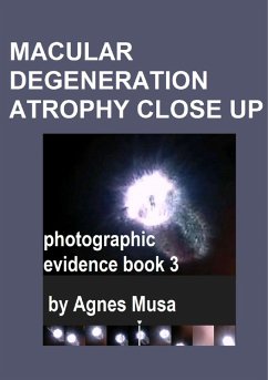 Cover Macular Degeneration Atrophy Close Up, Photographic Evidence Book 3 (Macular Degeneration Atrophy, Photographic Evidence Series of Books, #19) (eBook, ePUB)