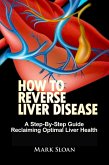 How To Reverse Liver Disease: A Step-By-Step Guide Reclaiming Optimal Liver Health (eBook, ePUB)