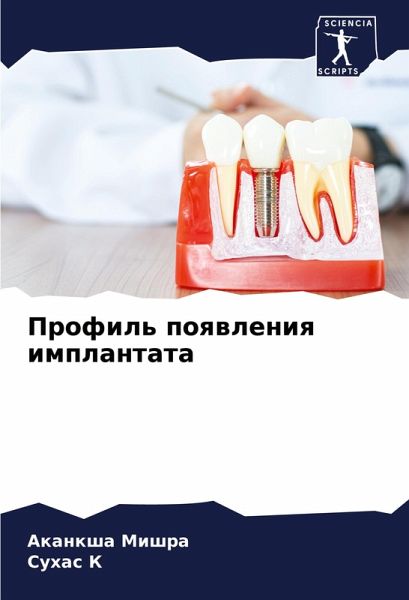 Profil' poqwleniq implantata Profil' poqwleniq implantata