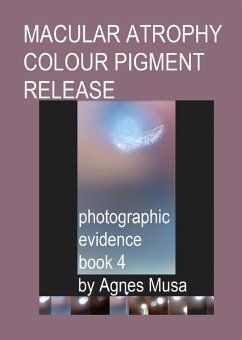 Cover Macular Atrophy Colour Pigment Release, Photographic Evidence Book 4 (Macular Degeneration Atrophy, Photographic Evidence Series of Books, #15) (eBook, ePUB)
