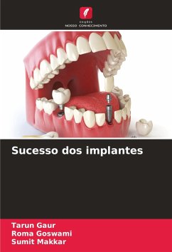 Cover Sucesso dos implantes