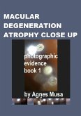 Macular Degeneration Atrophy Close Up, Photographic Evidence Book 1 (Macular Degeneration Atrophy, Photographic Evidence Series of Books, #17) (eBook, ePUB) Macular Degeneration Atrophy Close Up, Photographic Evidence Book 1 (Macular Degeneration Atrophy, Photographic Evidence Series of Books, #17) (eBook, ePUB)