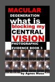 Macular Degeneration, What Is Blocking My Central Vision, Photographic Evidence Book 3 (eBook, ePUB) Macular Degeneration, What Is Blocking My Central Vision, Photographic Evidence Book 3 (eBook, ePUB)