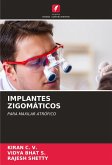 IMPLANTES ZIGOMÁTICOS IMPLANTES ZIGOMÁTICOS