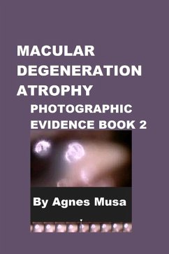 Cover Macular Degeneration Atrophy, Photographic Evidence Book 2 (Macular Degeneration Atrophy, Photographic Evidence Series of Books, #4) (eBook, ePUB)