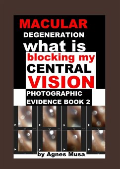 Cover Macular Degeneration, What Is Blocking My Central Vision, Photographic Evidence Book 2 (eBook, ePUB)