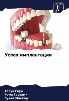 Cover Uspeh implantacii