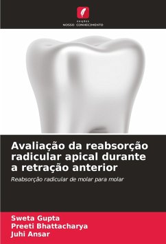 Avaliação da reabsorção radicular apical durante a retração anterior - Gupta, Sweta;Bhattacharya, Preeti;Ansar, Juhi