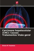 Carcinoma hepatocelular (CHC): Causas Tratamentos Visão geral