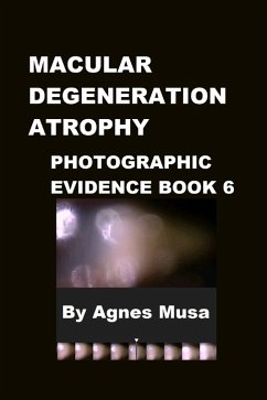 Cover Macular Degeneration Atrophy, Photographic Evidence Book 6 (Macular Degeneration Atrophy, Photographic Evidence Series of Books, #8) (eBook, ePUB)