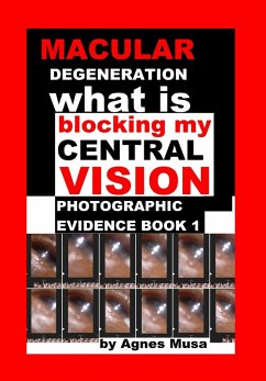 Macular Degeneration, What Is Blocking My Central Vision, Photographic Evidence Book 1 (eBook, ePUB) - Musa, Agnes