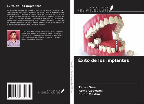 Éxito de los implantes Éxito de los implantes