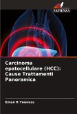 Carcinoma epatocellulare (HCC): Cause Trattamenti Panoramica