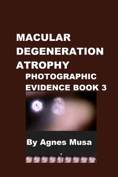 Cover Macular Degeneration Atrophy, Photographic Evidence Book 3 (Macular Degeneration Atrophy, Photographic Evidence Series of Books, #5) (eBook, ePUB)