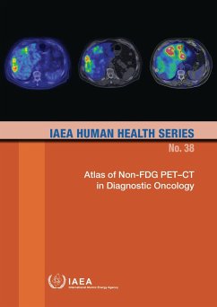 Cover Atlas of Non-FDG PET-CT in Diagnostic Oncology (eBook, ePUB)