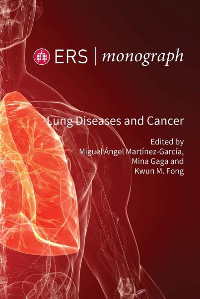 Lung Diseases and Cancer (eBook, ePUB) Lung Diseases and Cancer (eBook, ePUB)