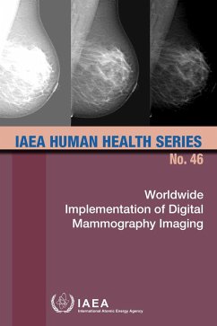 Worldwide Implementation of Digital Mammography Imaging (eBook, ePUB) - Iaea