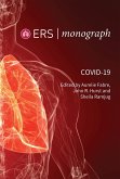 COVID-19 (eBook, PDF) COVID-19 (eBook, PDF)