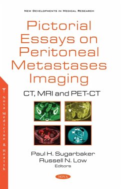 Cover Pictorial Essays on Peritoneal Metastases Imaging: CT, MRI and PET-CT (eBook, PDF)