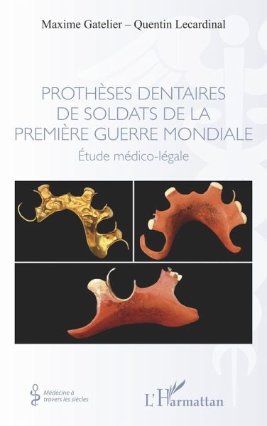 Prothèses dentaires de soldats de la Première Guerre Mondiale (eBook, ePUB)