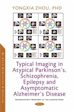 Typical Imaging in Atypical Parkinson's, Schizophrenia, Epilepsy and Asymptomatic Alzheimer's Disease (eBook, PDF) Typical Imaging in Atypical Parkinson's, Schizophrenia, Epilepsy and Asymptomatic Alzheimer's Disease (eBook, PDF)