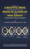 I Have a Beautiful Brain, Compared to the Brains of Alcoholics and Drug Addicts (eBook, ePUB)