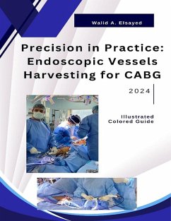 Cover Precision in Practice: Endoscopic Vessel Harvesting for CABG (eBook, ePUB)