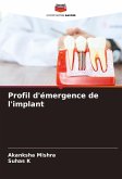 Profil d'émergence de l'implant Profil d'émergence de l'implant