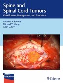 Spine and Spinal Cord Tumors Spine and Spinal Cord Tumors