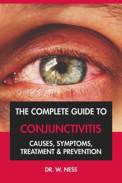 The Complete Guide to Conjunctivitis: Causes, Symptoms, Treatment & Prevention (eBook, ePUB) - Ness, W.