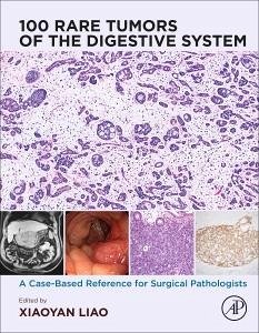 100 Rare Tumors of the Digestive System Cover 100 Rare Tumors of the Digestive System