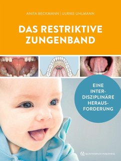 Cover Das restriktive Zungenband (eBook, PDF)