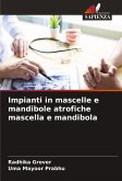 Impianti in mascelle e mandibole atrofiche mascella e mandibola Impianti in mascelle e mandibole atrofiche mascella e mandibola